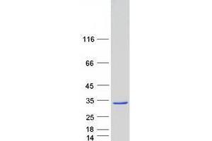 Validation with Western Blot