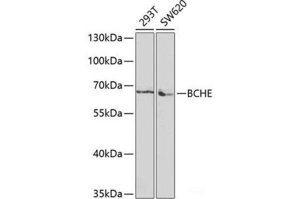 Butyrylcholinesterase Antikörper