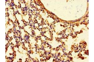 Immunohistochemistry of paraffin-embedded human lung tissue using ABIN7165823 at dilution of 1:100 (TTLL8 Antikörper  (AA 671-822))