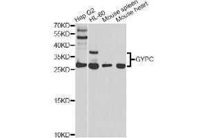 Western blot analysis of extracts of various cell lines, using GYPC antibody (ABIN5970574) at 1/1000 dilution. (CD236/GYPC Antikörper)