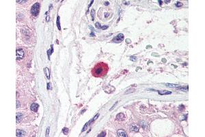 Anti-TACI antibody IHC of human testis, mast cell.