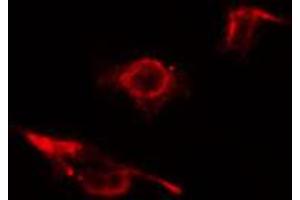 ABIN6274581 staining 293 cells by IF/ICC. (ADD2 Antikörper  (Internal Region))