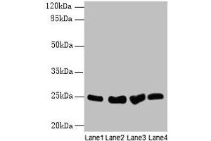 Western blot All lanes: Socs3 antibody at 12 μg/mL Lane 1: K562 whole cell lysate Lane 2: A375 whole cell lysate Lane 3: Hela whole cell lysate Lane 4: HepG2 whole cell lysate Secondary Goat polyclonal to rabbit IgG at 1/10000 dilution Predicted band size: 25 kDa Observed band size: 25 kDa (SOCS3 Antikörper  (AA 1-225))