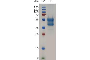 SDS-PAGE (SDS) image for Glycophorin A (GYPA) (AA 28-91) protein (Fc Tag) (ABIN7490775)