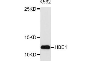 Western blot analysis of extracts of K-562 cells, using HBE1 antibody (ABIN5972085) at 1/1000 dilution.