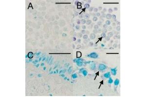 IHC staining for viral capsid protein with ABIN1000236: (A) Uninfected HeLa cells, (B) HRV16-infected HeLa cells, (C) Negative bronchial biopsy section, (D) Positive bronchial biopsy section. (Rhinovirus 16 Antikörper)