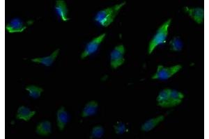 Immunofluorescence staining of U251 cells with ABIN7140169 at 1:50, counter-stained with DAPI. (TJP1 Antikörper  (AA 116-138))