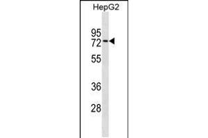 Western blot analysis in HepG2 cell line lysates (35ug/lane). (ZNF614 Antikörper  (AA 174-200))