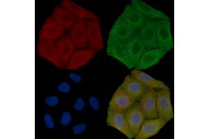 ABIN7096271 and ABIN7100333 staining Hela cells(30 min of UV treatment) by IF/ICC. (RNF145 Antikörper)