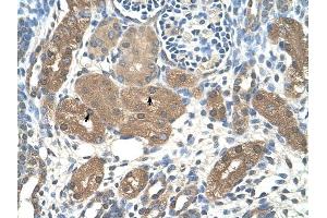 ACP1 antibody was used for immunohistochemistry at a concentration of 4-8 ug/ml to stain Epithelial cells of renal tubule (arrows) in Human Kidney.