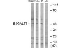 Western blot analysis of extracts from Jurkat/HeLa/HepG2 cells, using B4GALT3 Antibody. (B4GALT3 Antikörper  (AA 271-320))