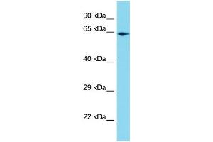 Host: Rabbit Target Name: PPIL4 Sample Type: HepG2 Whole Cell lysates Antibody Dilution: 1. (PPIL4 Antikörper  (C-Term))