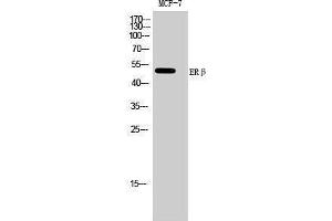 Western Blotting (WB) image for anti-Estrogen Receptor 2 (ESR2) (Ser368) antibody (ABIN3184558) (ESR2 Antikörper  (Ser368))
