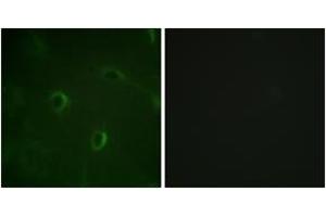 Immunofluorescence (IF) image for anti-Insulin Receptor (INSR) (AA 1326-1375) antibody (ABIN2888665) (Insulin Receptor Antikörper  (AA 1326-1375))