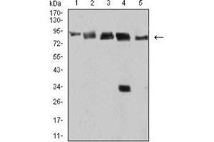 Western Blotting (WB) image for anti-DEAD (Asp-Glu-Ala-Asp) Box Polypeptide 1 (DDX1) (AA 642-740) antibody (ABIN5542504)