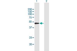 Western Blot analysis of TRIM62 expression in transfected 293T cell line by TRIM62 MaxPab polyclonal antibody. (TRIM62 Antikörper  (AA 1-475))