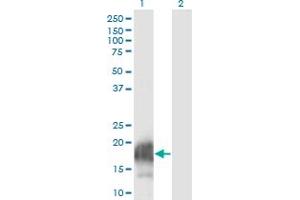 Western Blot analysis of CARHSP1 expression in transfected 293T cell line by CARHSP1 monoclonal antibody (M08), clone 4G10. (CARHSP1 Antikörper  (AA 1-147))
