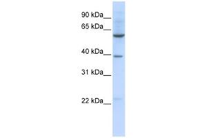 WB Suggested Anti-SLC35F3 Antibody Titration:  0. (SLC35F3 Antikörper  (Middle Region))