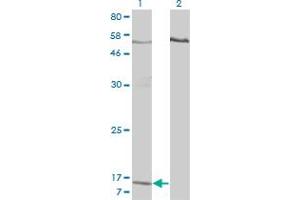 Western Blot analysis of PPBP expression in transfected 293T cell line by PPBP monoclonal antibody (M01), clone 3B9. (CXCL7 Antikörper  (AA 37-128))