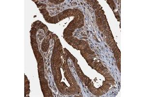 Immunohistochemical staining of human gallbladder with APOL5 polyclonal antibody  shows strong cytoplasmic and membranous positivity in glandular cells at 1:50-1:200 dilution. (Apolipoprotein L 5 Antikörper)