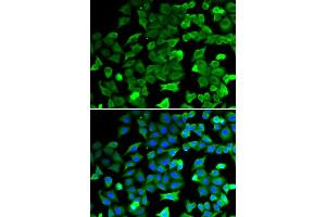 Immunofluorescence analysis of HeLa cells using SIRT2 antibody. (SIRT2 Antikörper)