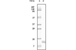 Western Blotting (WB) image for anti-Synuclein, gamma (Breast Cancer-Specific Protein 1) (SNCG) antibody (ABIN1107306) (SNCG Antikörper)