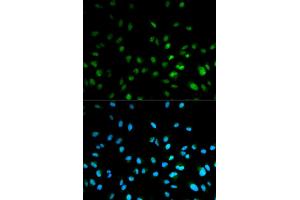 Immunofluorescence analysis of MCF-7 cells using HDAC3 antibody. (HDAC3 Antikörper)