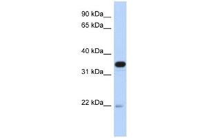 PITPNB antibody used at 1 ug/ml to detect target protein. (PITPNB Antikörper  (Middle Region))