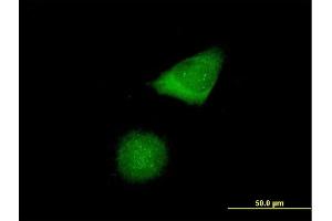 Immunofluorescence of purified MaxPab antibody to CENPH on HeLa cell. (CENPH Antikörper  (AA 1-247))