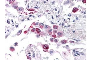 Human Lung: Formalin-Fixed, Paraffin-Embedded (FFPE) (EFHD1 Antikörper  (N-Term))