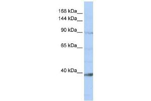 NCKAP1L antibody used at 0.