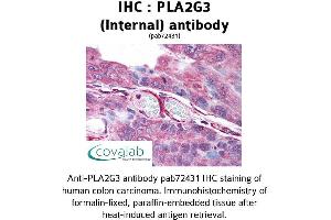 Image no. 1 for anti-Phospholipase A2, Group III (PLA2G3) (Internal Region) antibody (ABIN1738136) (PLA2G3 Antikörper  (Internal Region))