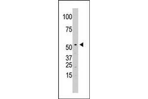 The SPPL2A polyclonal antibody  is used in Western blot to detect SPPL2A in Jurkat cell lysate. (SPPL2A Antikörper  (N-Term))