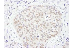 Immunohistochemistry (IHC) image for anti-Thymine-DNA Glycosylase (TDG) (AA 360-410) antibody (ABIN7455026) (TDG Antikörper  (AA 360-410))