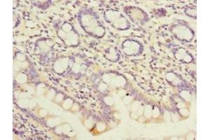 Immunohistochemistry of paraffin-embedded human small intestine tissue using ABIN7162961 at dilution of 1:100 (PEX19 Antikörper  (AA 1-299))