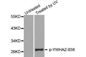 Western blot analysis of extracts from Hela cells, using Phospho-YWHAZ-S58 antibody. (14-3-3 zeta Antikörper  (pSer58))
