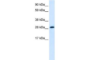 WB Suggested Anti-ABT1 Antibody Titration:  1.