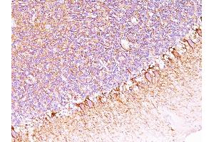 Formalin-fixed, paraffin-embedded human Cerebellum stained with Neurofilament Monoclonal Antibody (SPM563). (NEFH Antikörper)
