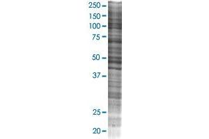MSLN transfected lysate.