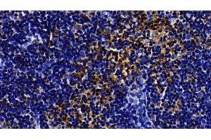 Immunohistochemistry (IHC) image for anti-Toll-Like Receptor 5 (TLR5) (AA 325-644) antibody (ABIN7444148)