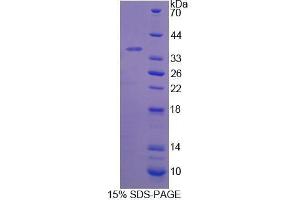 SDS-PAGE analysis of Rat beta Thromboglobulin Protein. (beta-Thromboglobulin Protein (beta-TG))