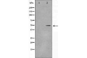 Western blot analysis on 293 cell lysate using DLX3 Antibody,The lane on the left is treated with the antigen-specific peptide.