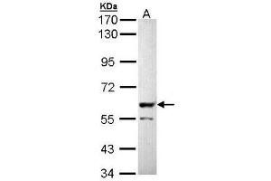 Western Blot analysis: PPP3CB antibody staining of Molt-4 whole cell lysate (Lane A, 30 µg) at 1/5000 dilution. (PPP3CB Antikörper)