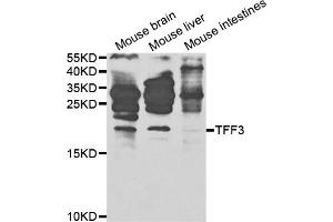 Western blot analysis of extracts of various cell lines, using TFF3 antibody (ABIN5971028) at 1/1000 dilution. (TFF3 Antikörper)