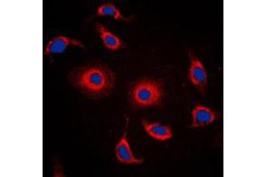 Immunofluorescent analysis of FXR2 staining in HepG2 cells.