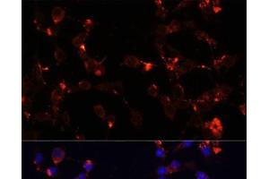 Immunofluorescence analysis of NIH/3T3 cells using WDR81 Polyclonal Antibody at dilution of 1:100. (WDR81 Antikörper)