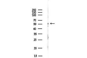 Western blot analysis of lysates from Hela cells(UV, 30 min treatment), using TRIM72 Antibody at 1/1000 dilution.