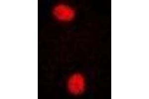 Immunofluorescent analysis of PRPF3 staining in U2OS cells.