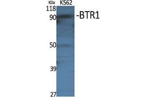 Western Blotting (WB) image for anti-Solute Carrier Family 4, Sodium Borate Transporter, Member 11 (SLC4A11) (Internal Region) antibody (ABIN6282648)