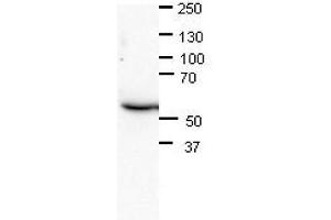 Western Blotting (WB) image for anti-Chromatin Assembly Factor 1, Subunit B (p60) (CHAF1B) (N-Term) antibody (ABIN2782376)